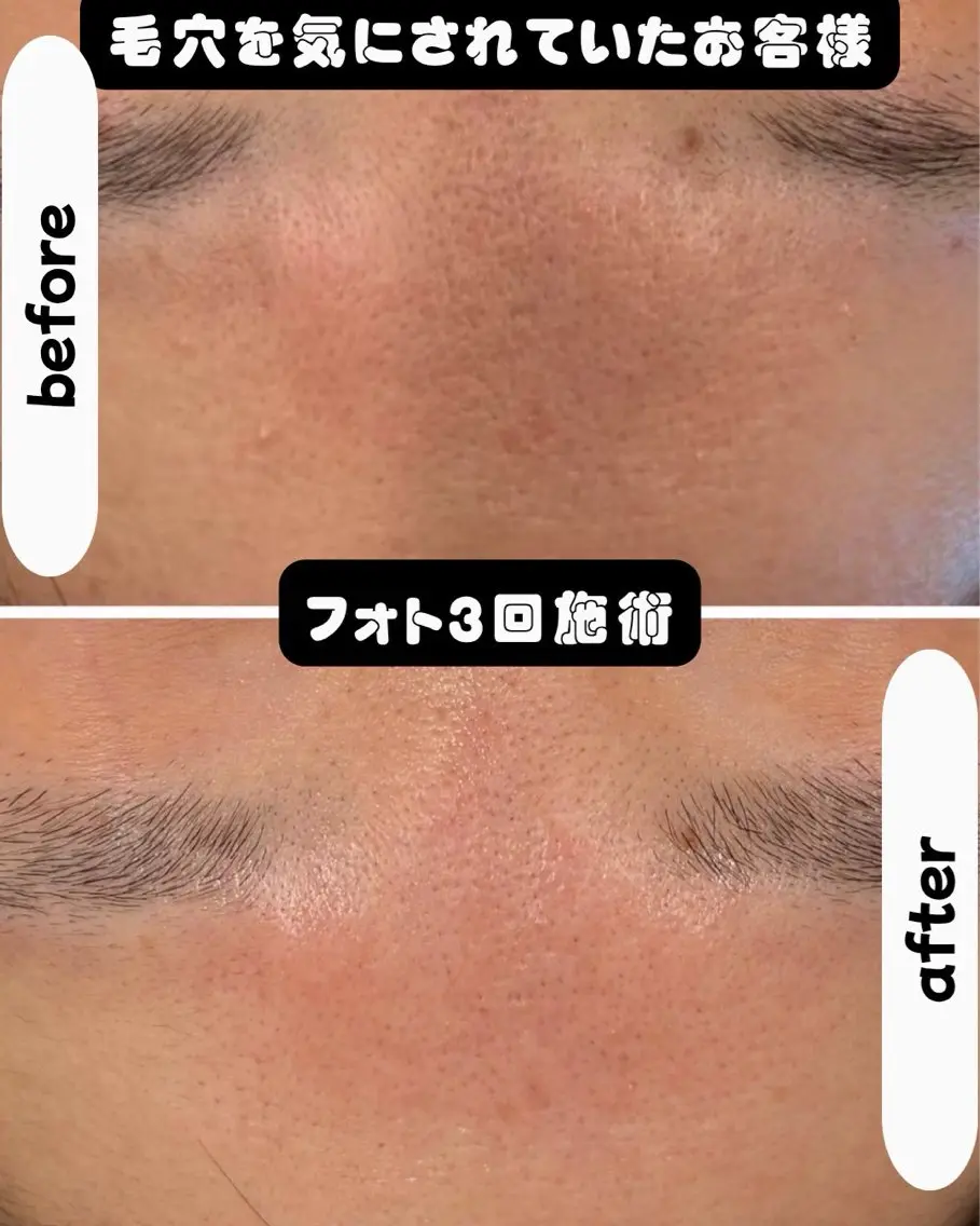エステ シミケア専門サロン LICCO’S岡崎のエステ・リラクイメージ