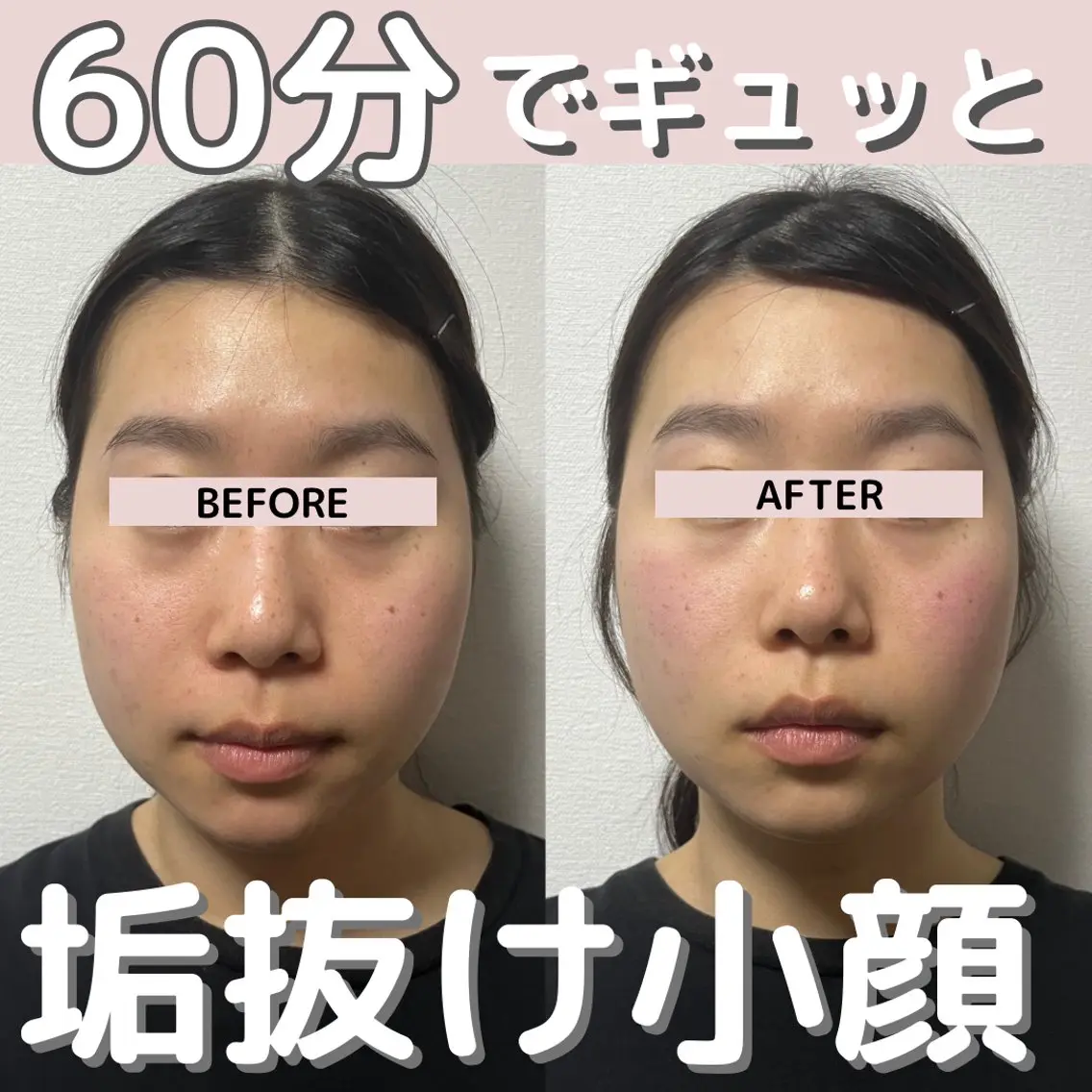 小顔矯正/骨格矯正 AKANEのエステ・リラクイメージ