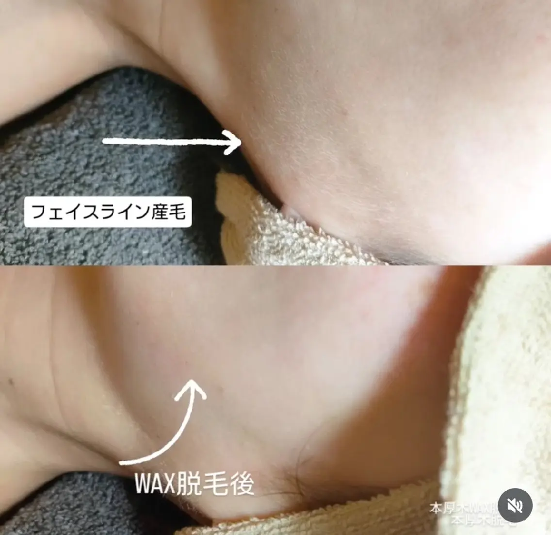 脱毛 本厚木南口 徒歩3分のネイルデザイン