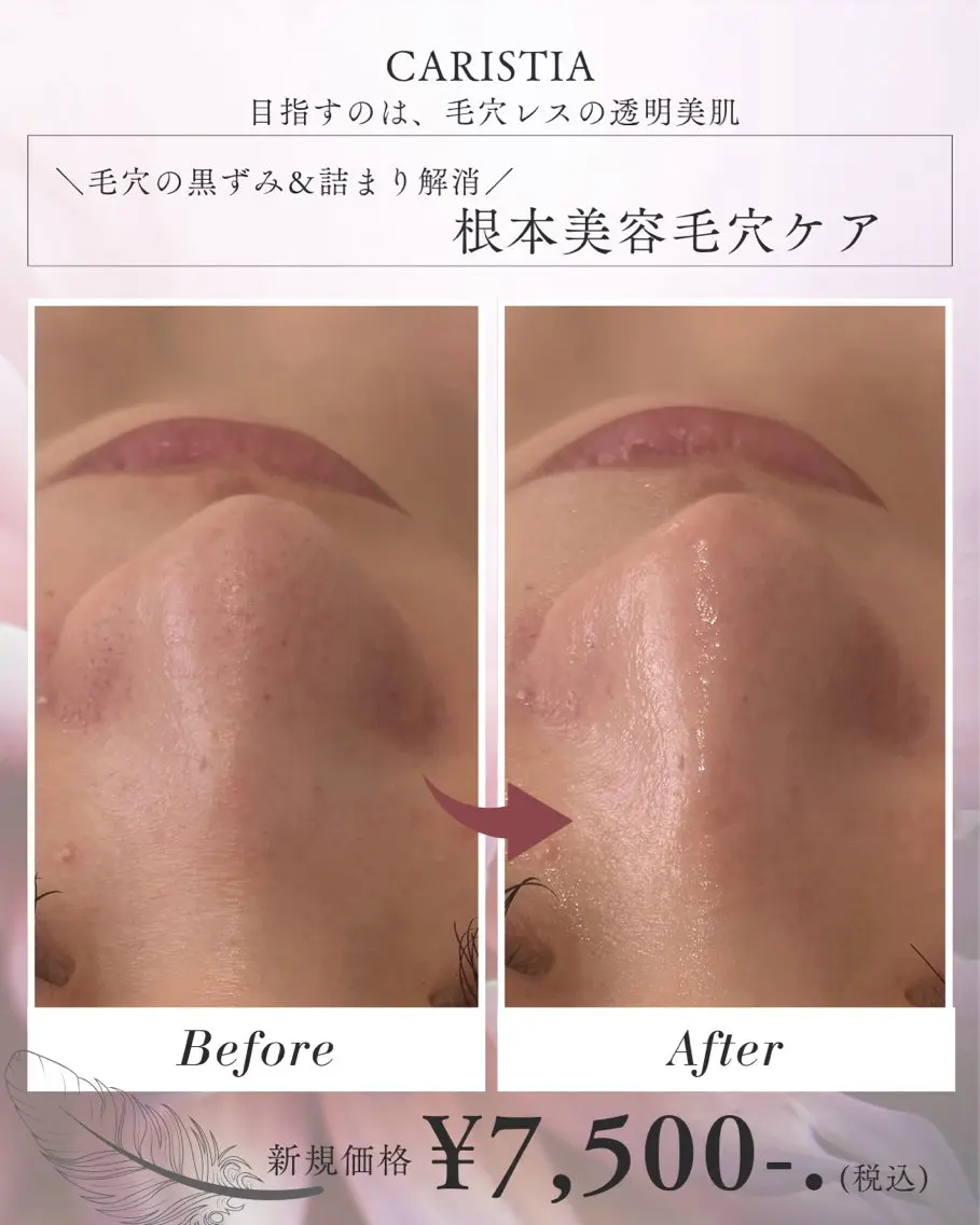 【超贅沢★目元も毛穴もケア】似合わせまつ毛パーマ ＋ リアムールプレミアムパック15分✨姫路・東姫路の写真