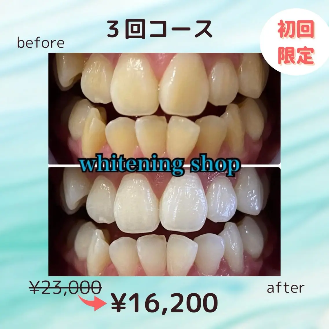 💎お試しコース3回来店💎¥23,000→¥16,200の写真