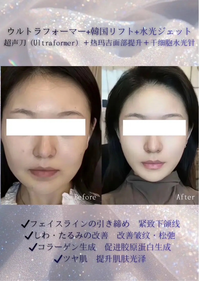 マツエク・マツパ エステ 愛維美水光美肌専門店 メンズレディースokのエステ・リラクイメージ