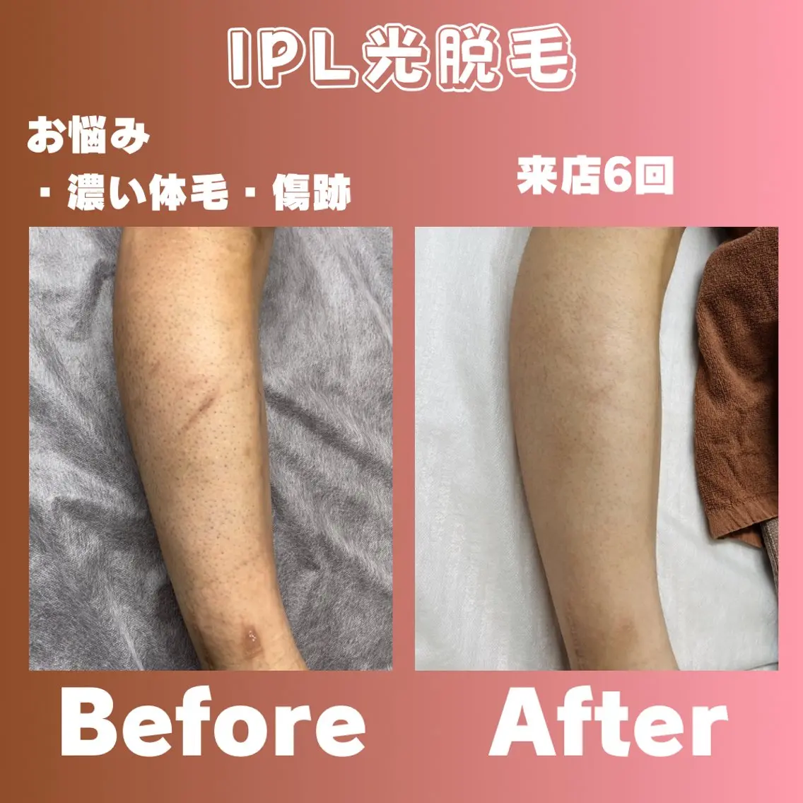 営業マンにオススメ!!★メンズも手元綺麗に垢抜け★腕or膝下の写真