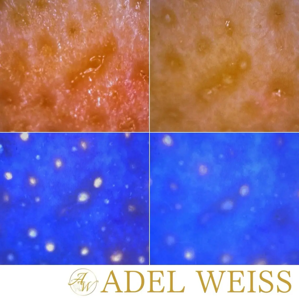 ADEL WEISS 脱毛&毛穴&リンパのその他イメージ