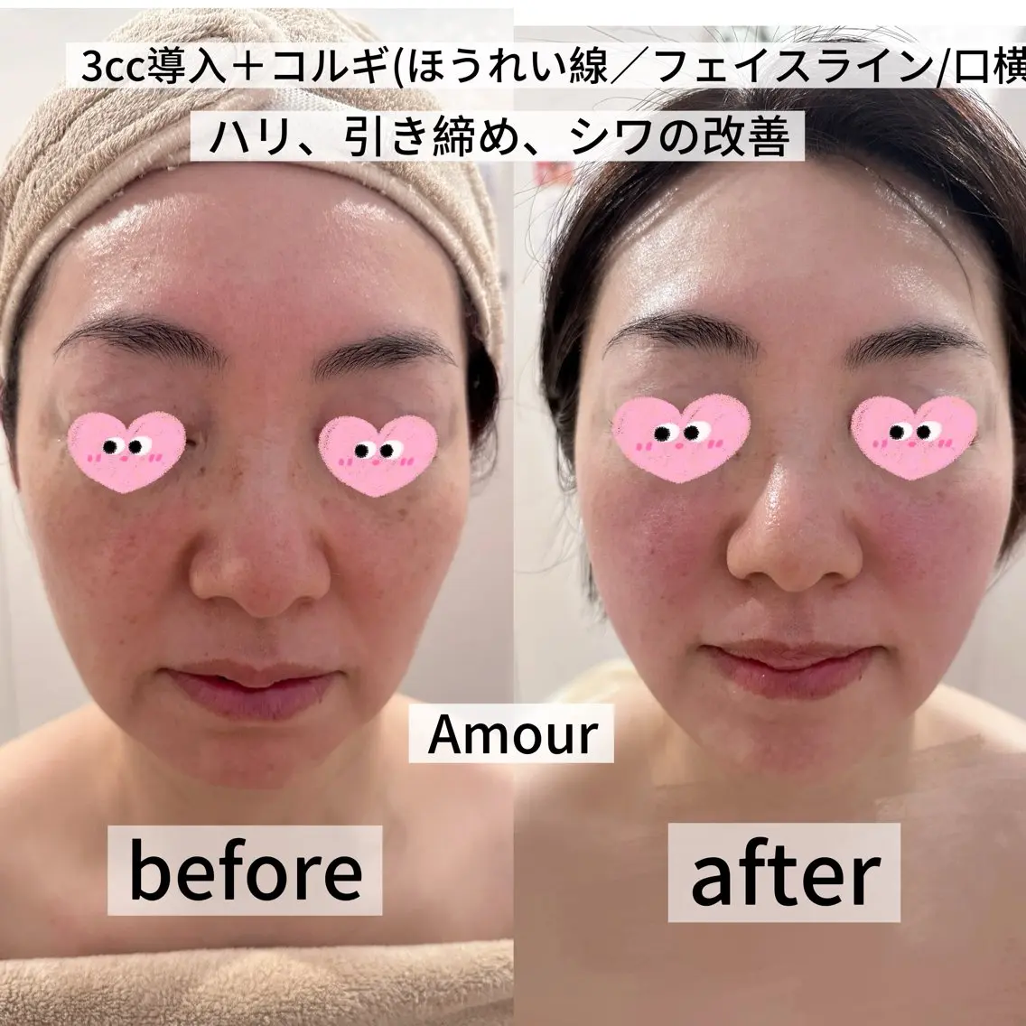 痩身・小顔・脱毛・ オイル&Amourのその他イメージ