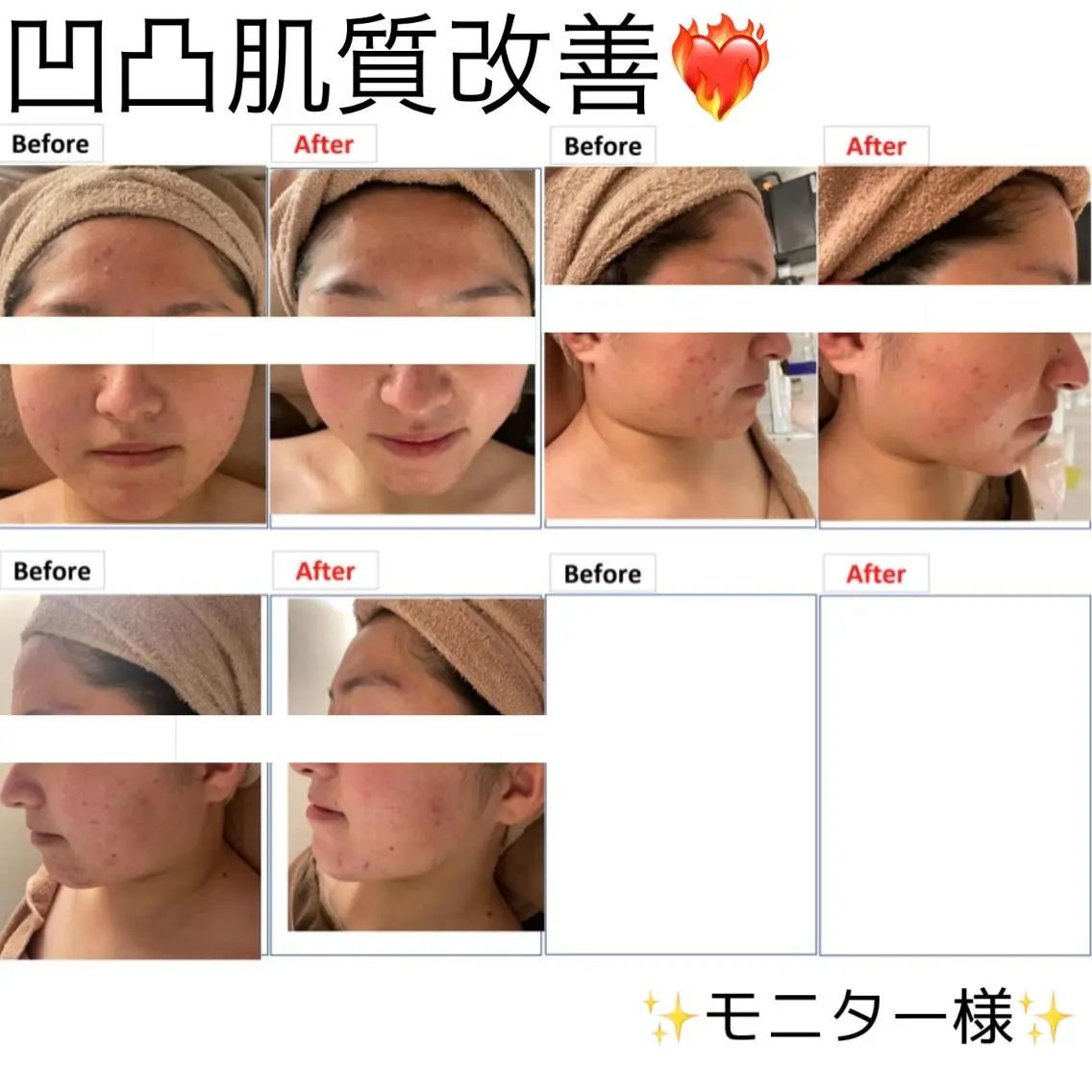 脱毛 レイビス 渋谷店波間❤️のエステ・リラクイメージ