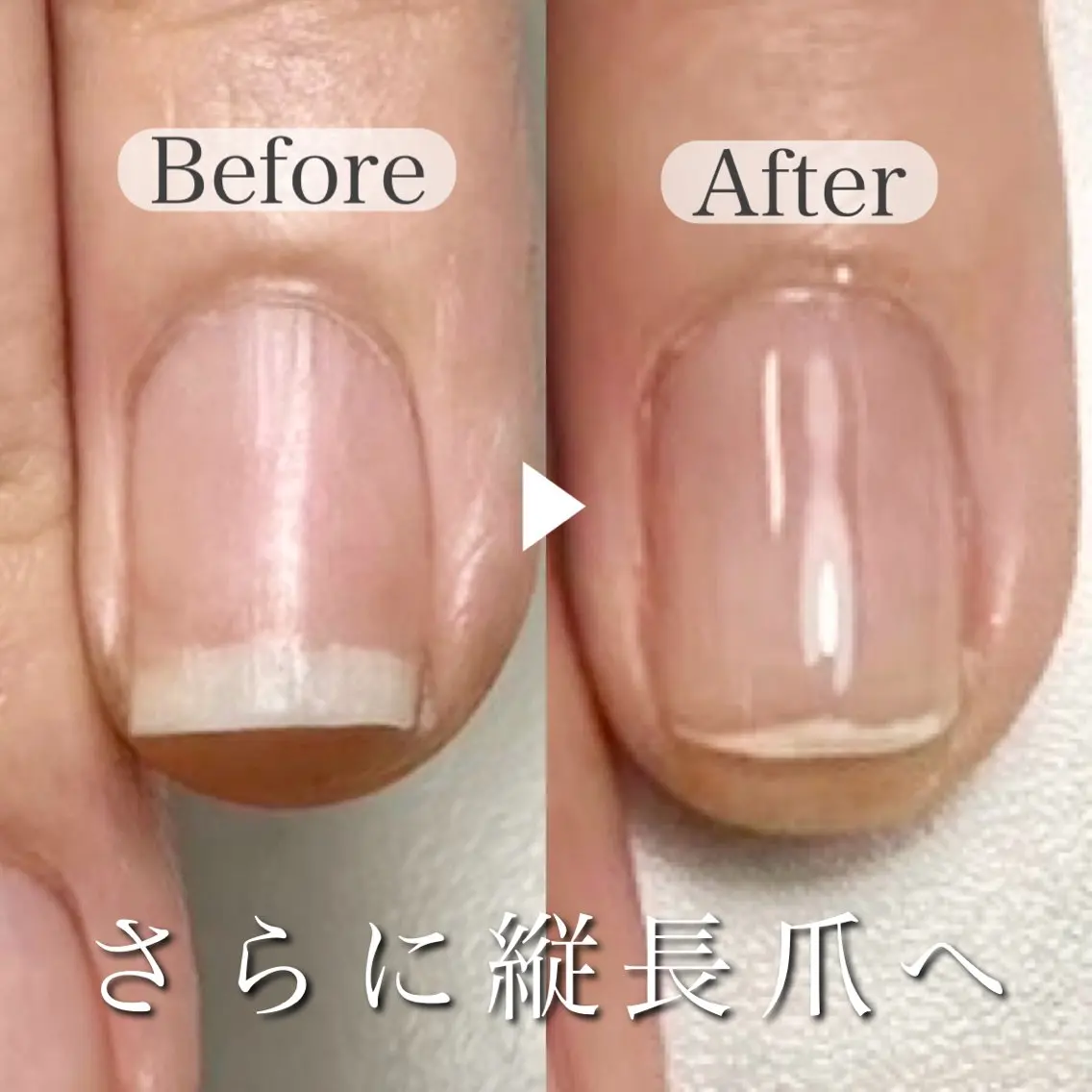 ネイル ピンク 深爪専門店 サロンリリーのネイルデザイン