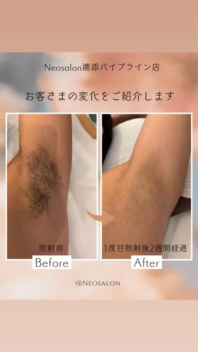 メンズ 脱毛 Neosalon ネオサロンのエステ・リラクイメージ