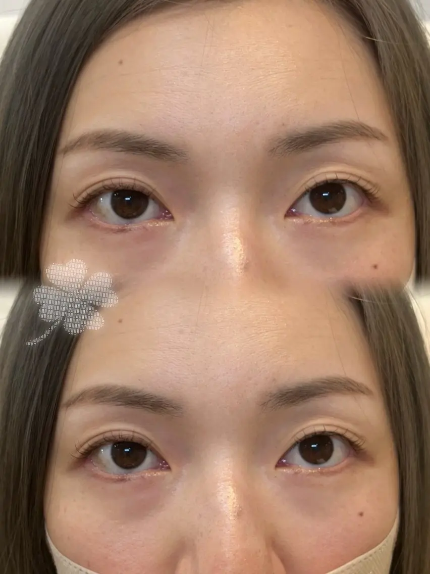 マツエク・マツパ マツパ nicott. renaの眉毛・アイブロウイメージ