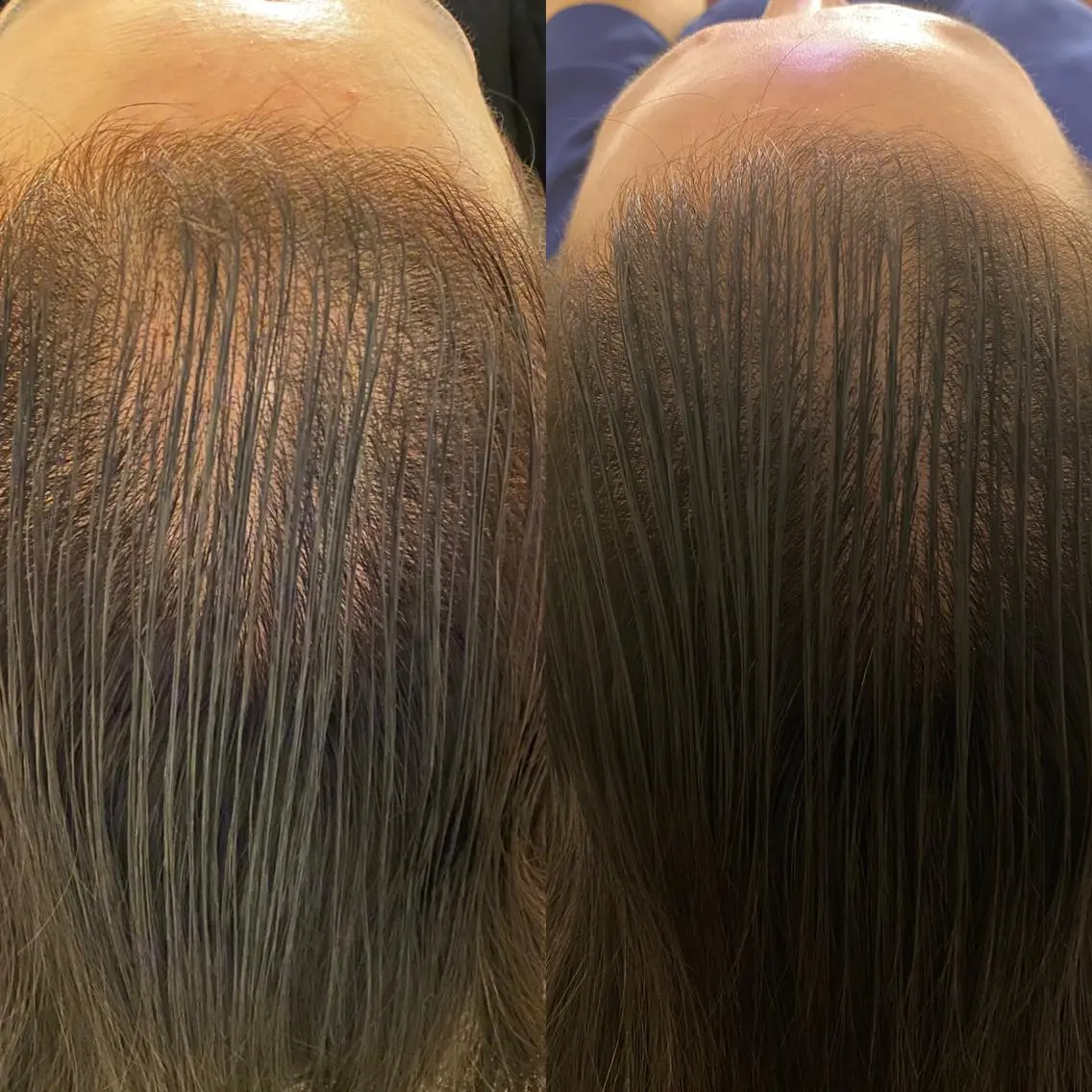 ミディアム カラー パーマ ヘアアレンジ acco  フェイシャル 育毛のエステ・リラクイメージ