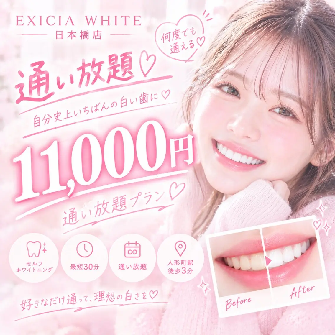 その他 セルフホワイトニング エクシアホワイトのその他イメージ