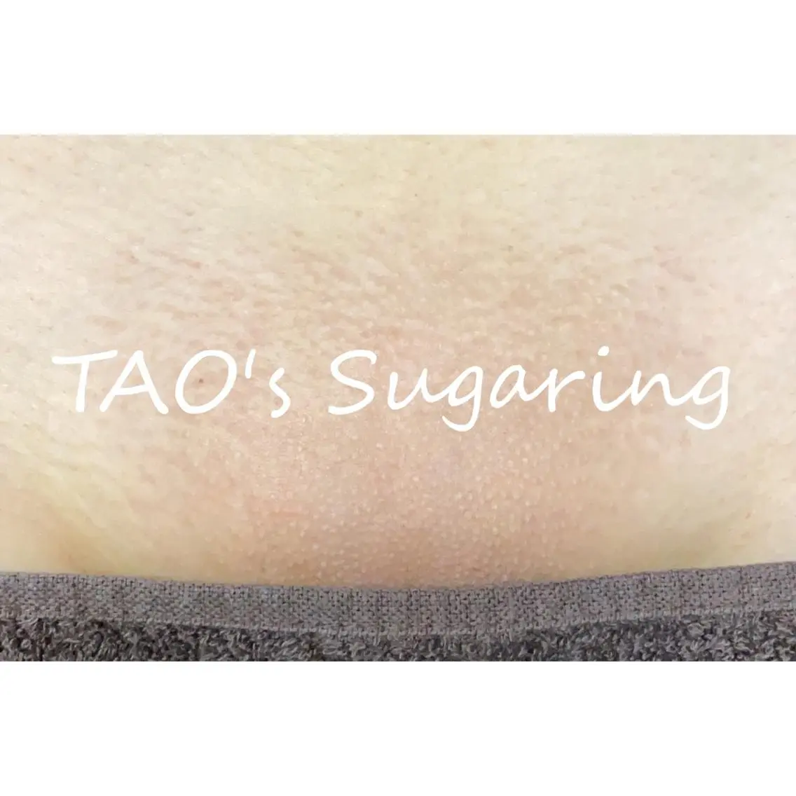 Sugaring / HILOT TAOのエステ・リラクイメージ