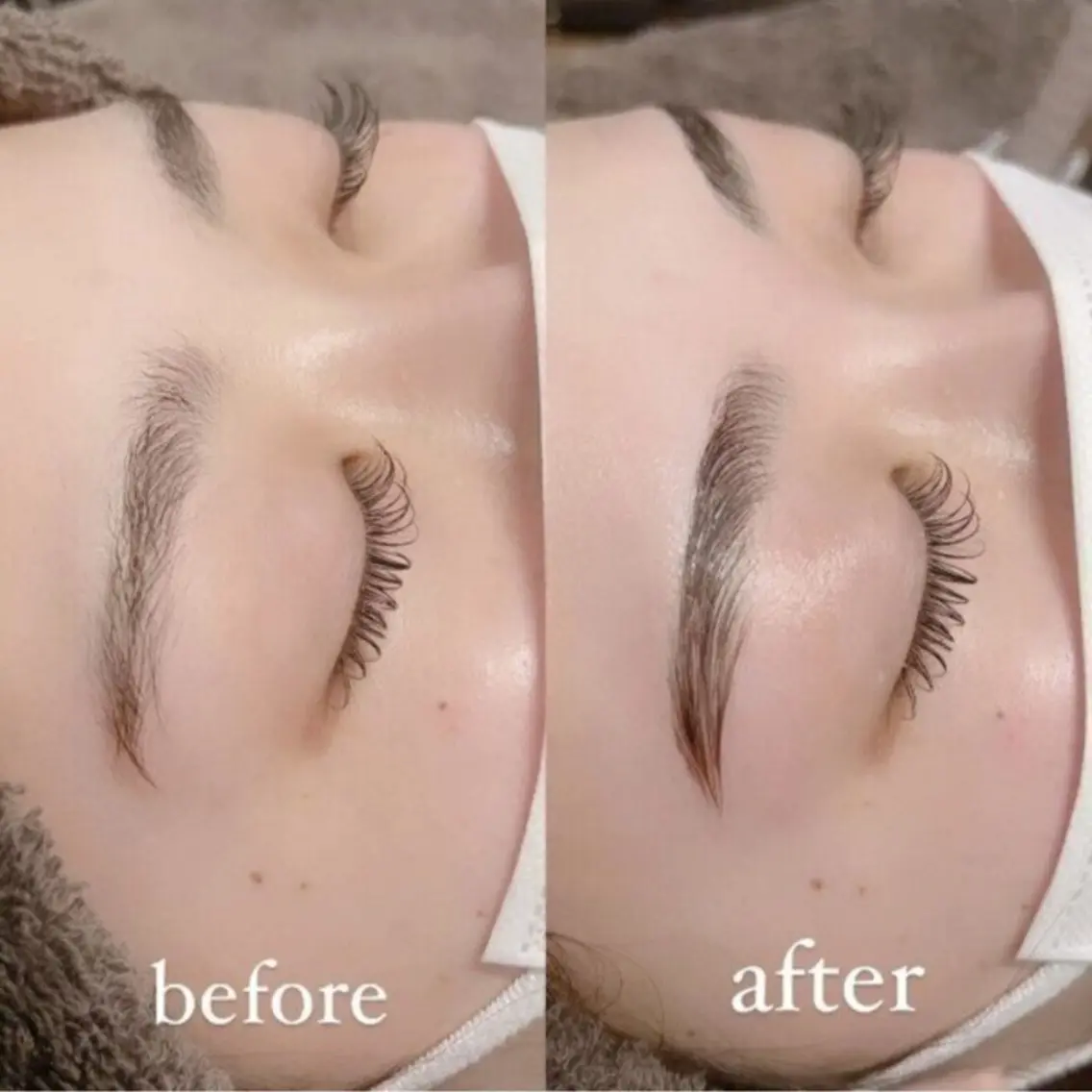 ✨️美眉WAX脱毛+間引きつき✨️の写真