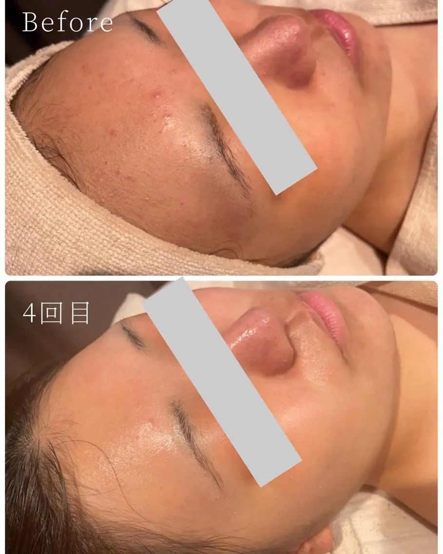 太田 玲奈のエステ・リラクイメージ