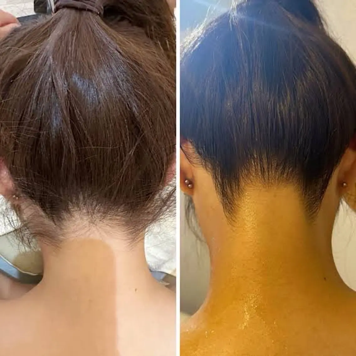 ［うなじ美人ワックス脱毛］夏に向けてアップスタイルを楽しみたい方、ショートヘアの方など垢抜けたうなじ美人に✨の写真