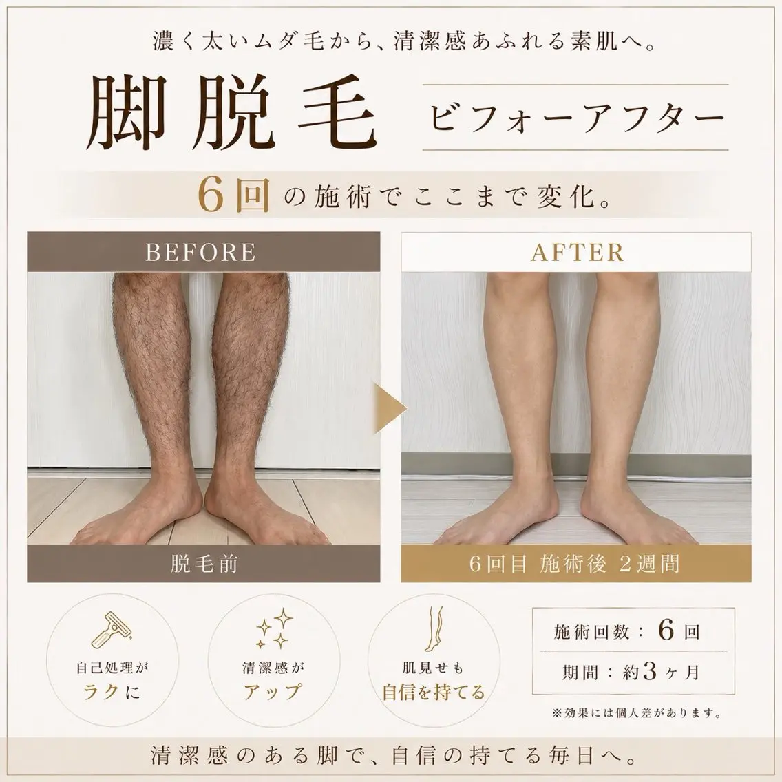 脱毛 みんなの脱毛ツルリン ☀️船橋店☀️のエステ・リラクイメージ