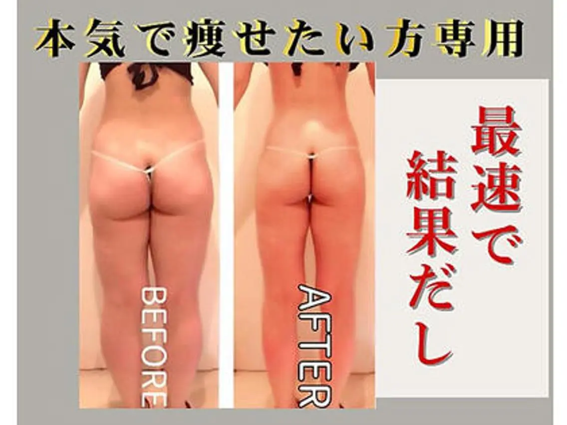 【全身痩身🌻/平日限定】🍉夏までに🔥体型を変える💎気になる全身まるごと全身痩身90分🍉の写真