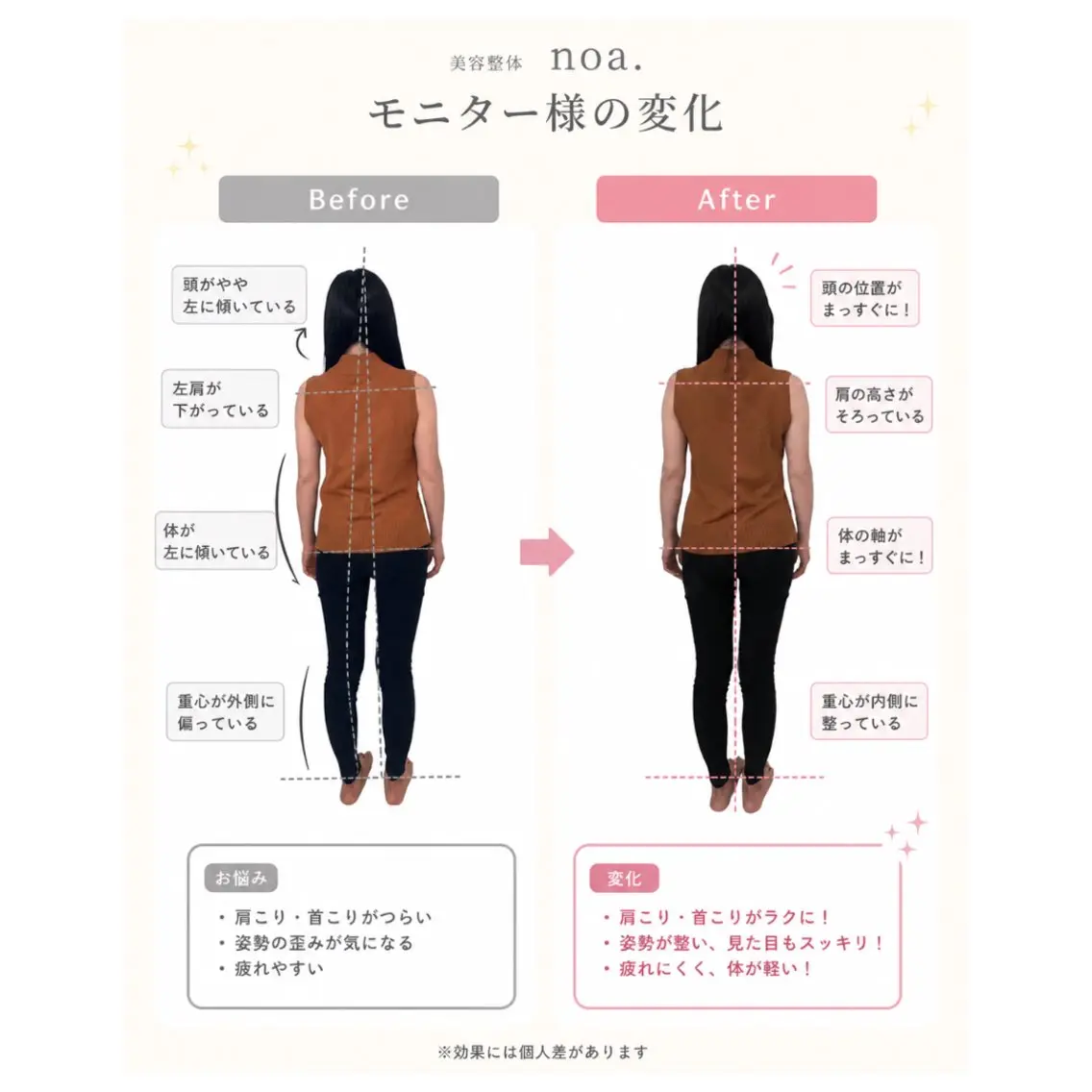 撮影モデル ばば まさみのエステ・リラクイメージ