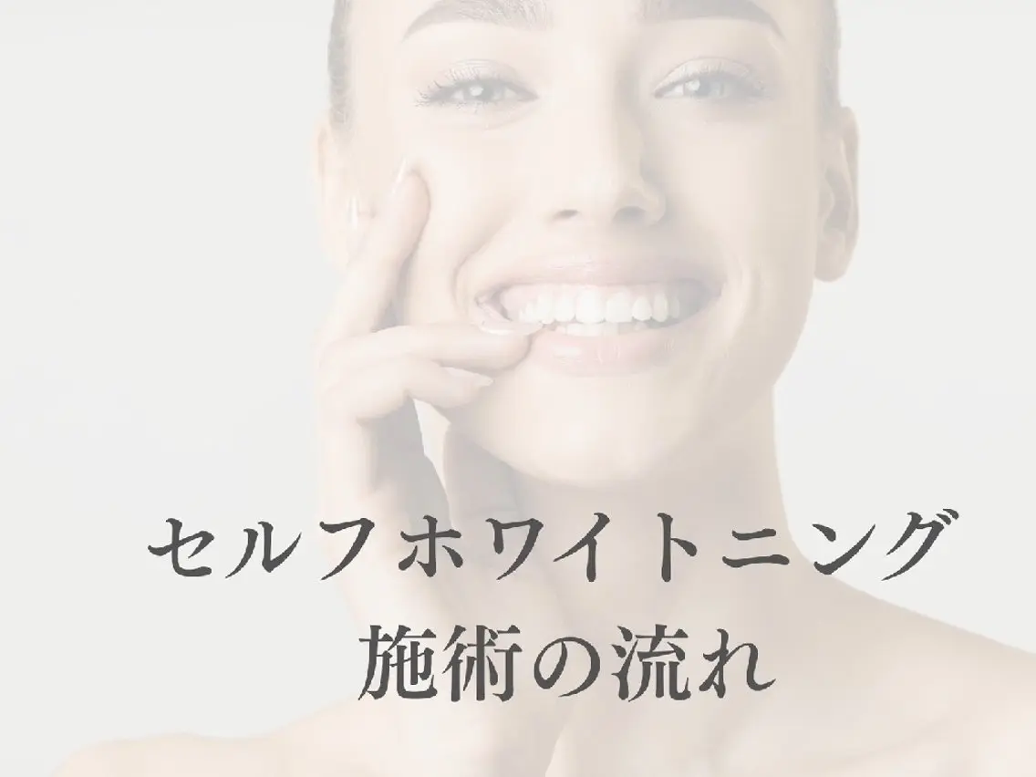 エステ リラク セルフホワイトニング WHITE福岡天神店のエステ・リラクイメージ