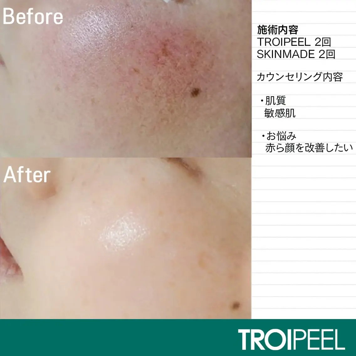 トロイアルケ🩵 美眉EMIの眉毛・アイブロウイメージ