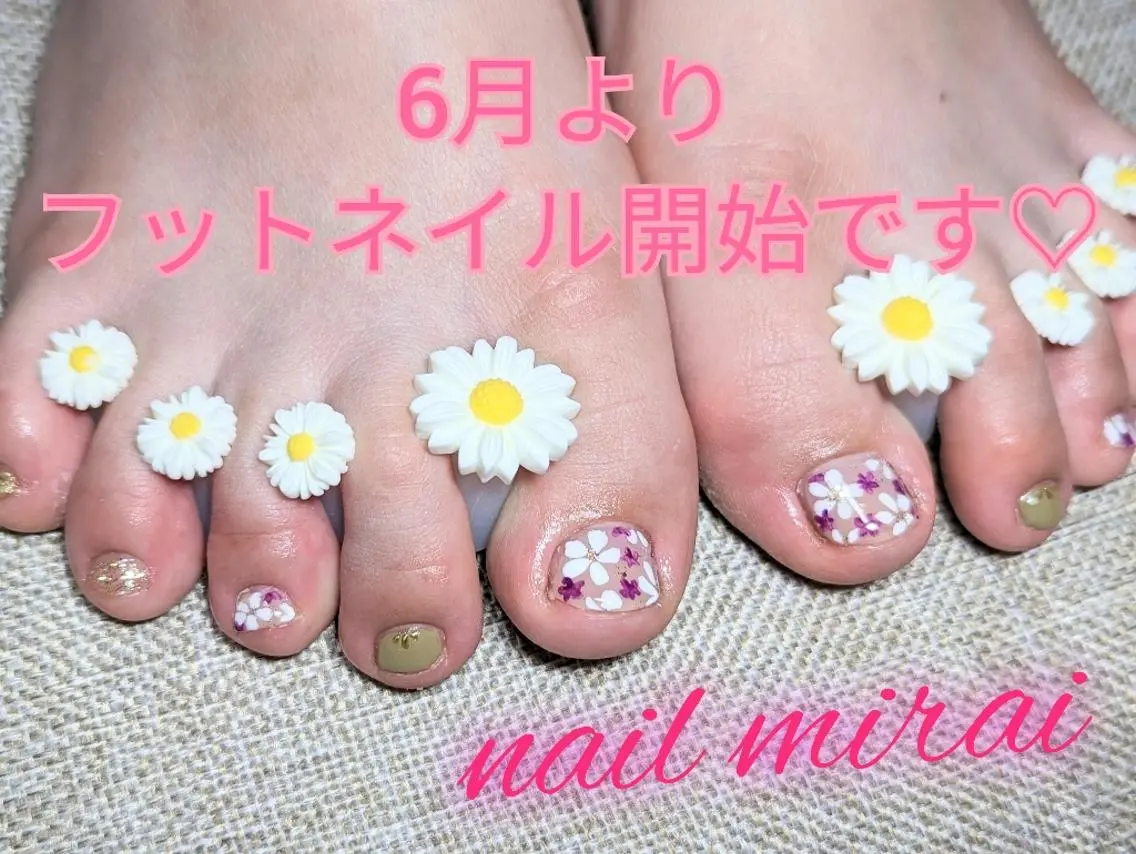 フットネイル♡親指デザイン付/パラジェル/オフ無料の写真