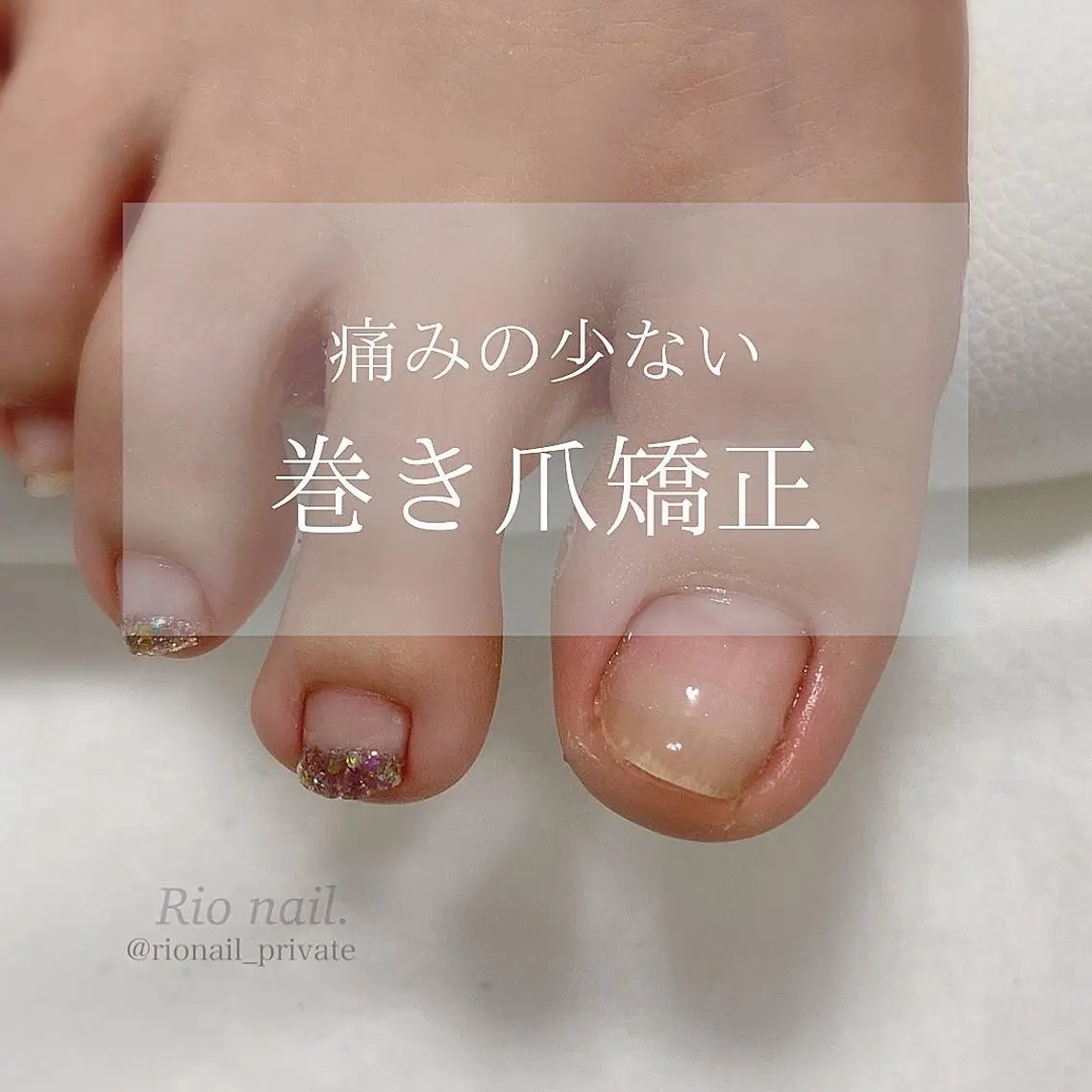 ネイル nailsalon linneのネイルデザイン