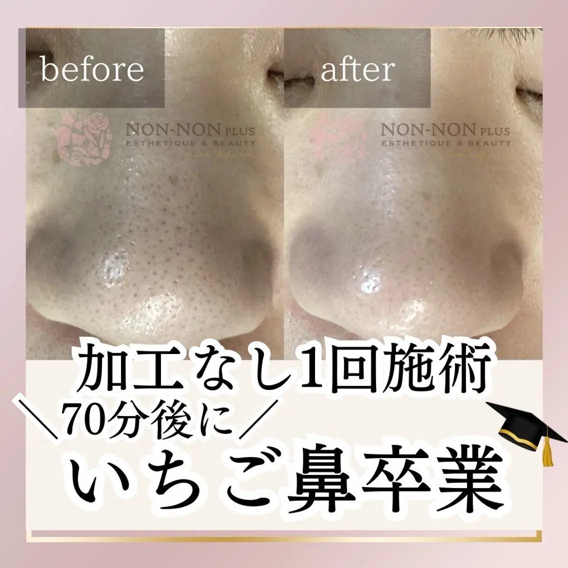 NON-NONプラス 大人の本気痩身のエステ・リラクイメージ