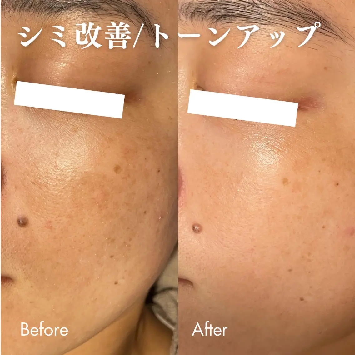 エステ Lassy Yuriの眉毛・アイブロウイメージ
