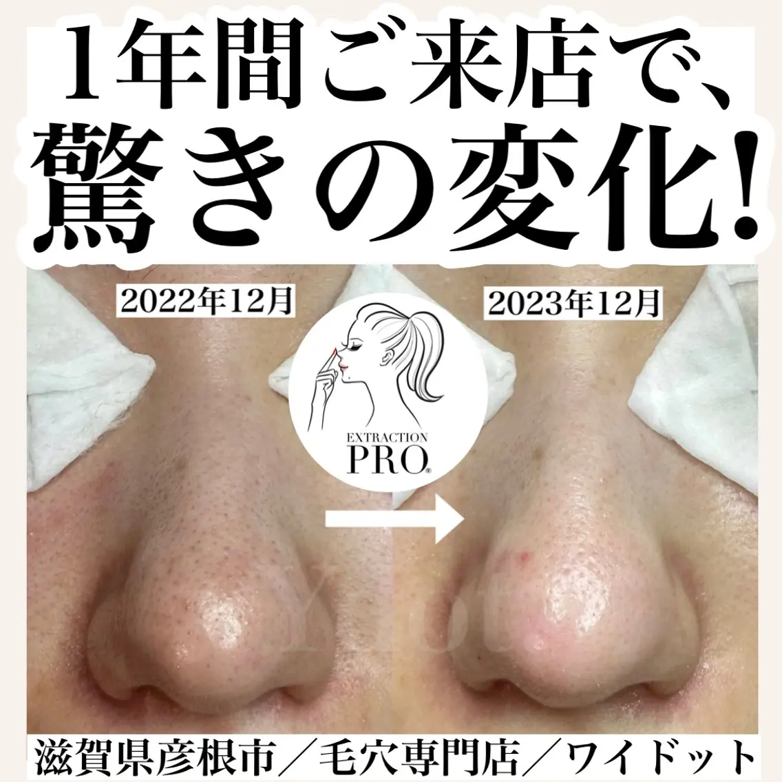 エステ Ydot. 池内 友架のエステ・リラクイメージ
