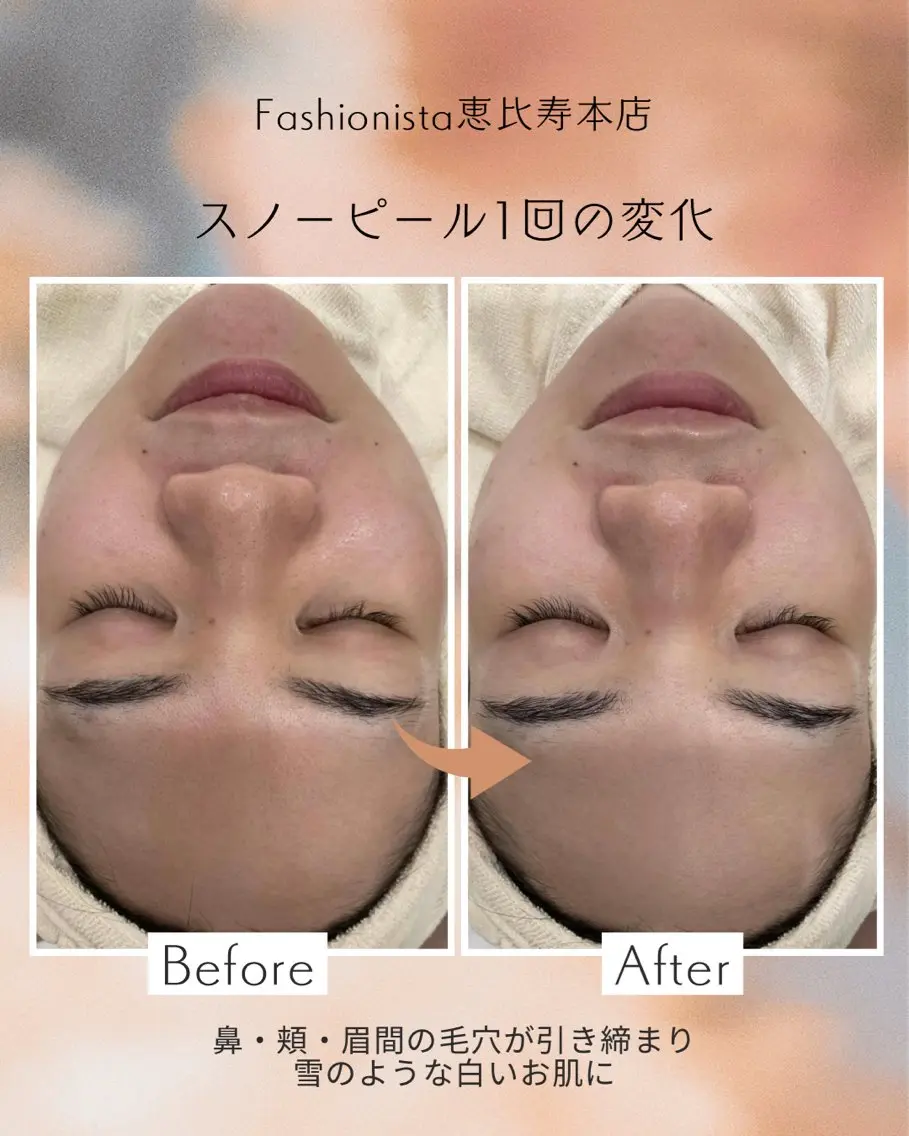 ファッショニスタ mihiroのエステ・リラクイメージ