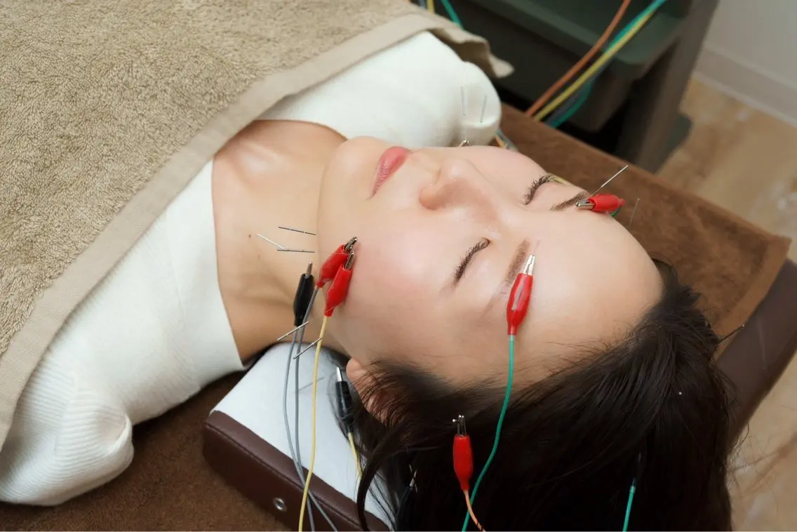 【女性限定】電気を流す美容鍼プレミアムの写真