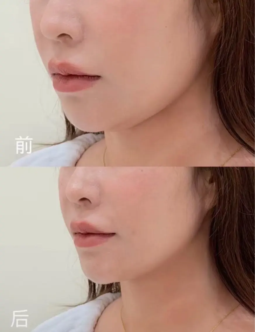 マツエク・マツパ エステ 愛維美水光専門店 川崎彩鳳のエステ・リラクイメージ