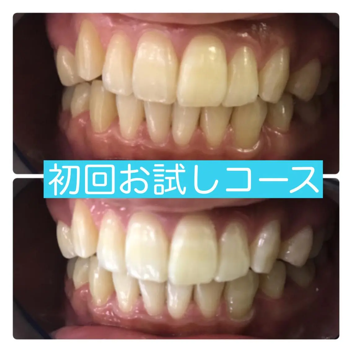 ホワイトニングルーム 横浜店のその他イメージ