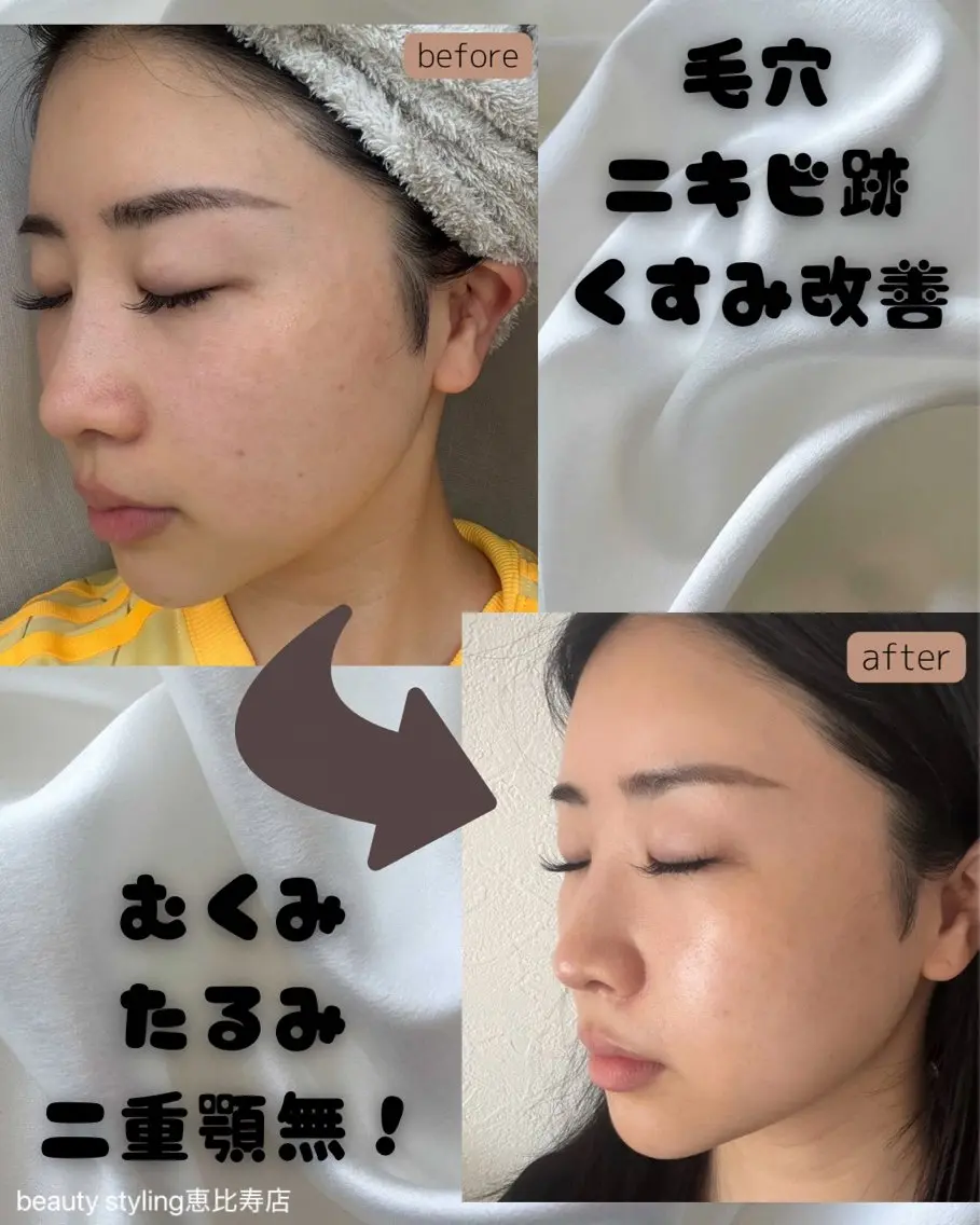 痩身｜美肌サロン 上西のエステ・リラクイメージ