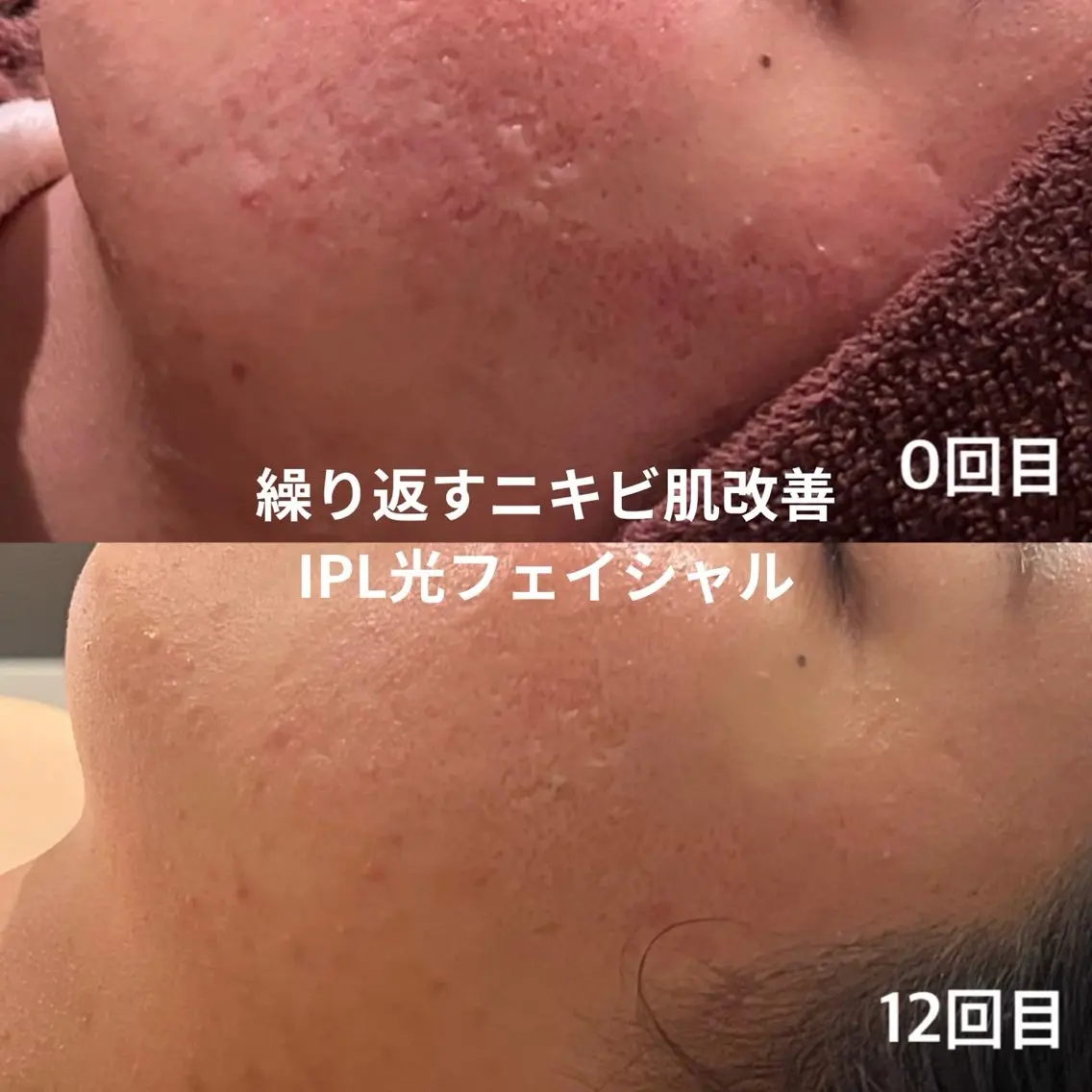 【LEPUS】レプス nishimoriのエステ・リラクイメージ