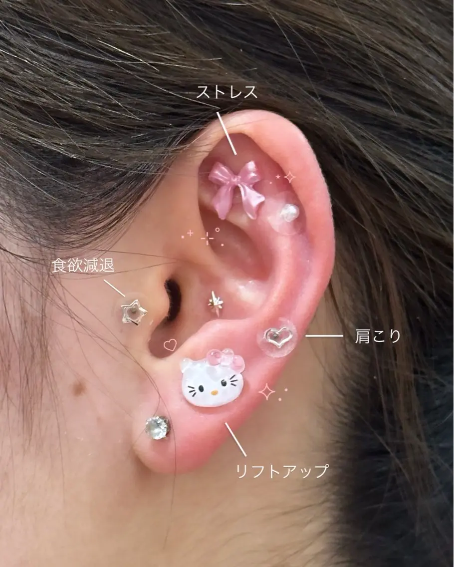 耳つぼjewelry⋆˙⟡の写真