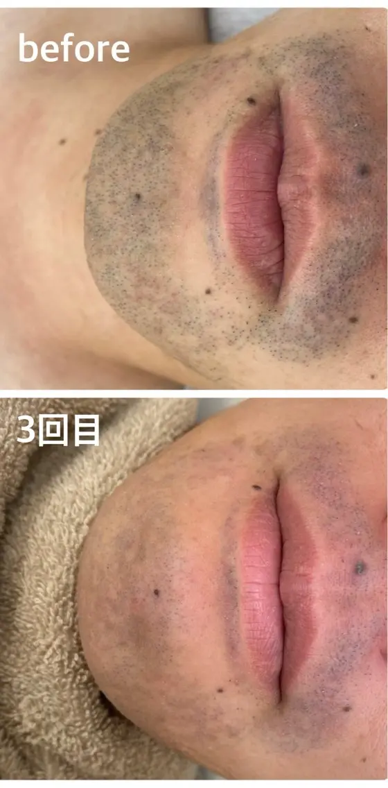 メンズ Bellme. 西山のエステ・リラクイメージ