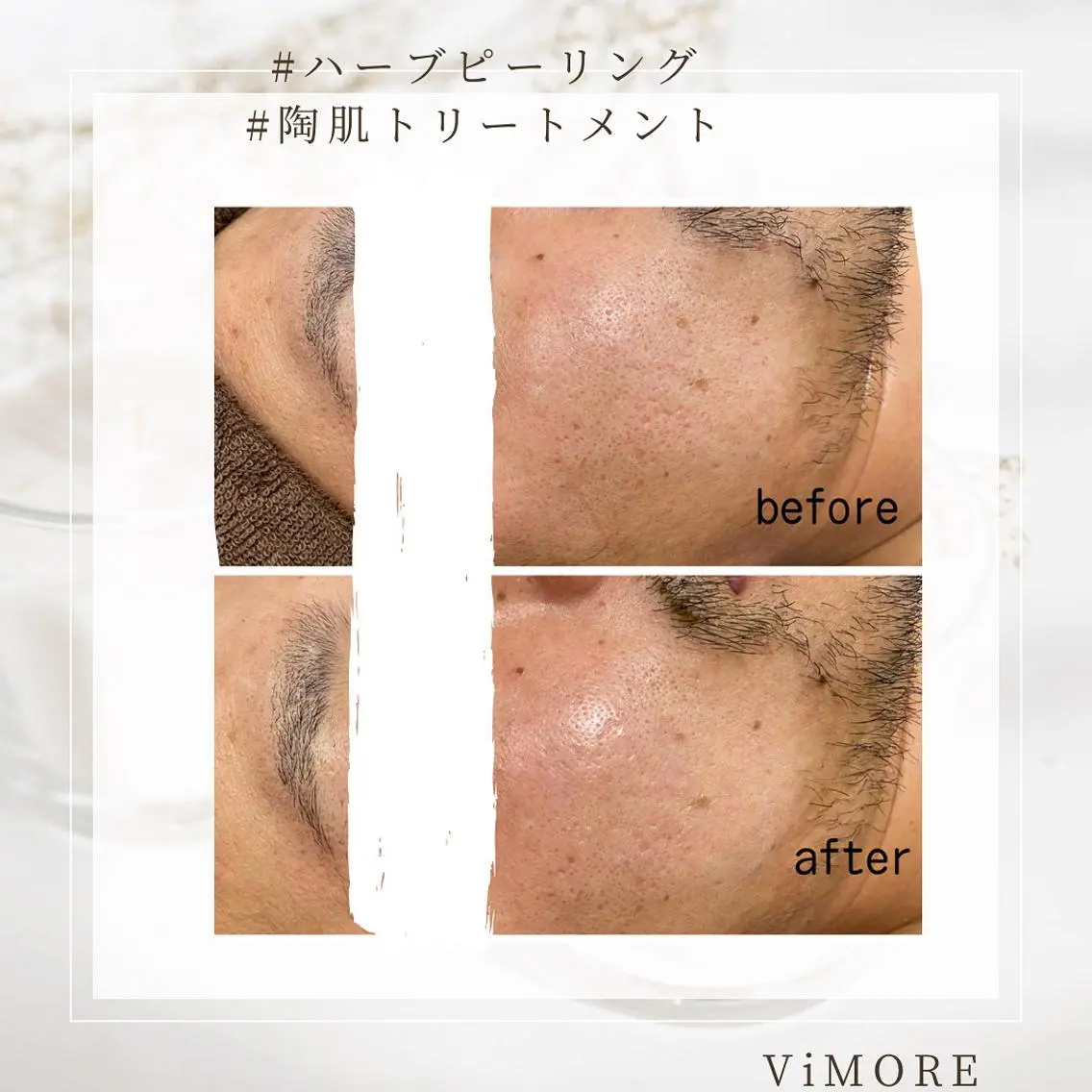 ViMORE あやのネイルデザイン