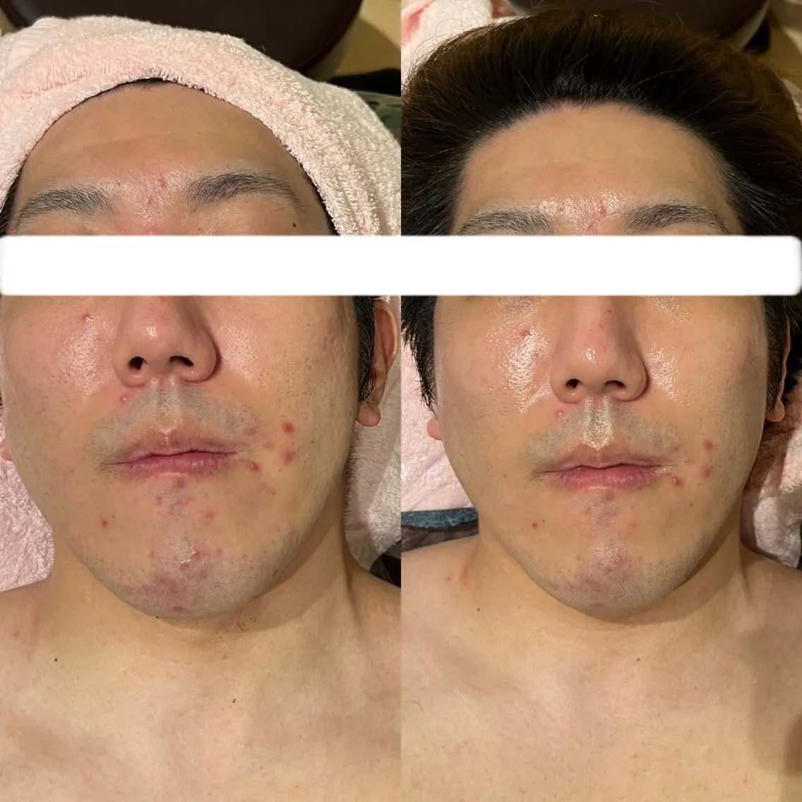 エステ Relaxation SalonARONAのエステ・リラクイメージ
