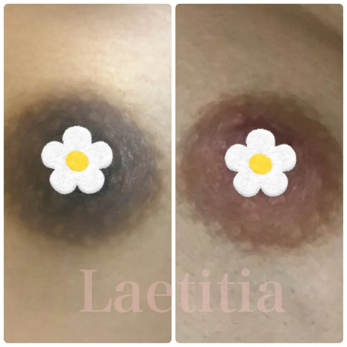 レティティア (Laetitia)のエステ・リラクイメージ