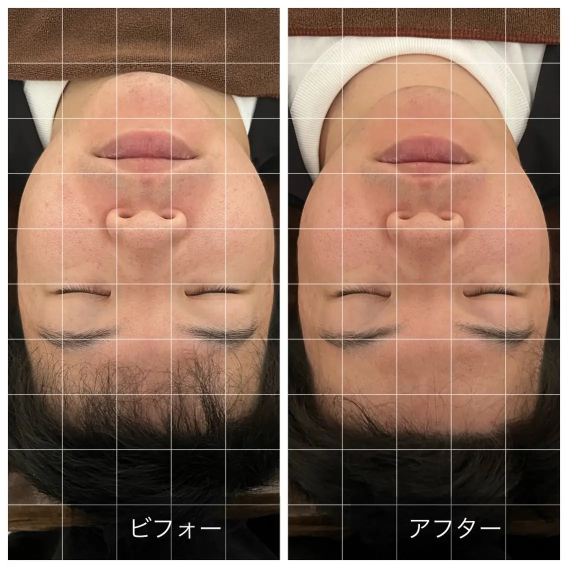 Relaxsalon undoのエステ・リラクイメージ
