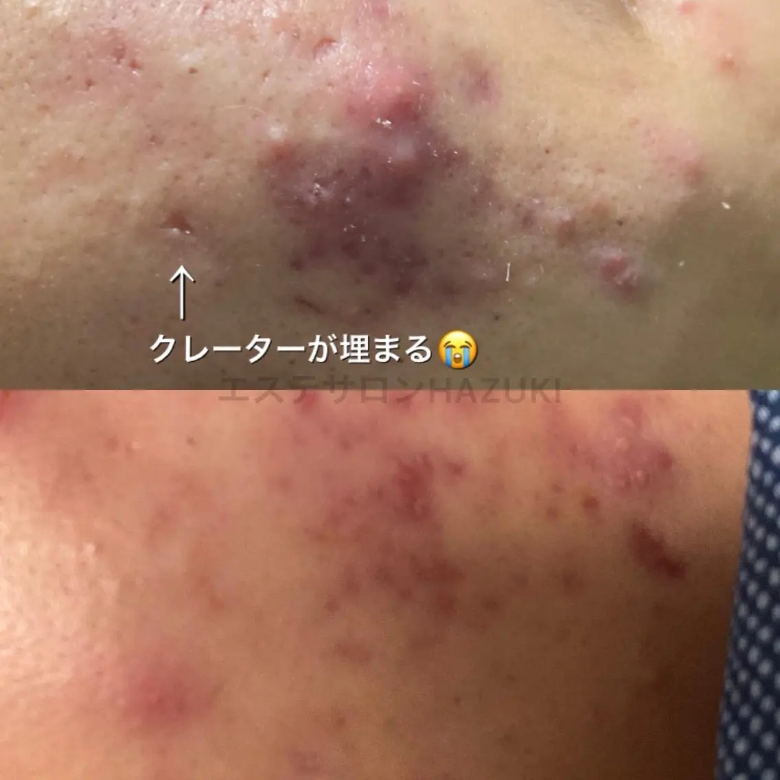 その他 たるみ改善小顔エステ 堀葉月のその他イメージ