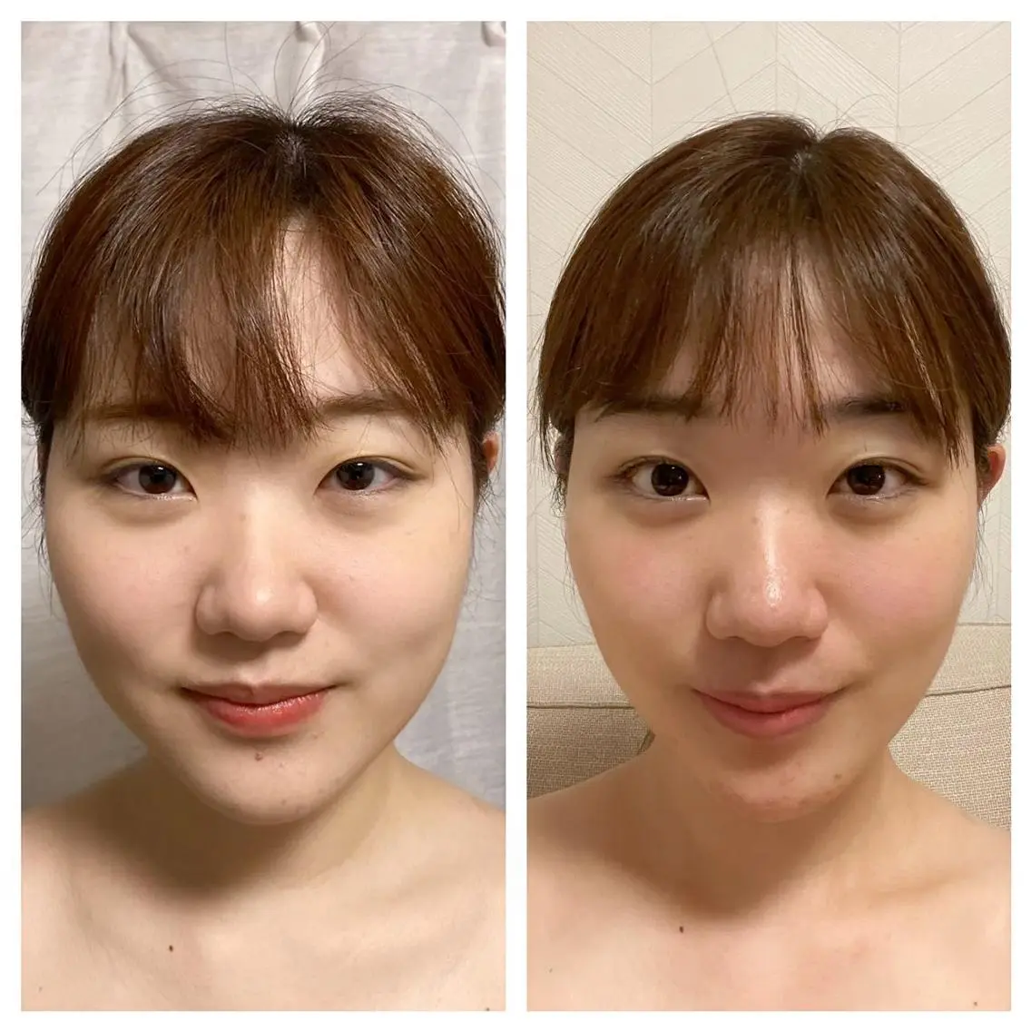 【お顔のむくみ・シミ・シワ・ホウレイ線の対策に】リンパフェイシャル60分15000円→8000円の写真