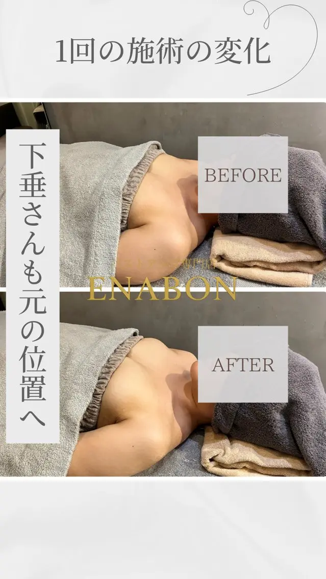 エステ バストアップサロン ENABON  上野のエステ・リラクイメージ