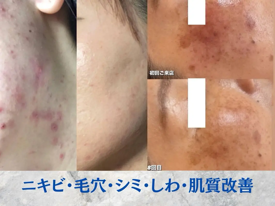 エステ リラク Esthetics 911横浜のエステ・リラクイメージ
