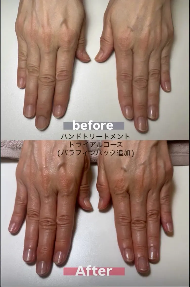 ハンドトリートメント トライアルコースの写真