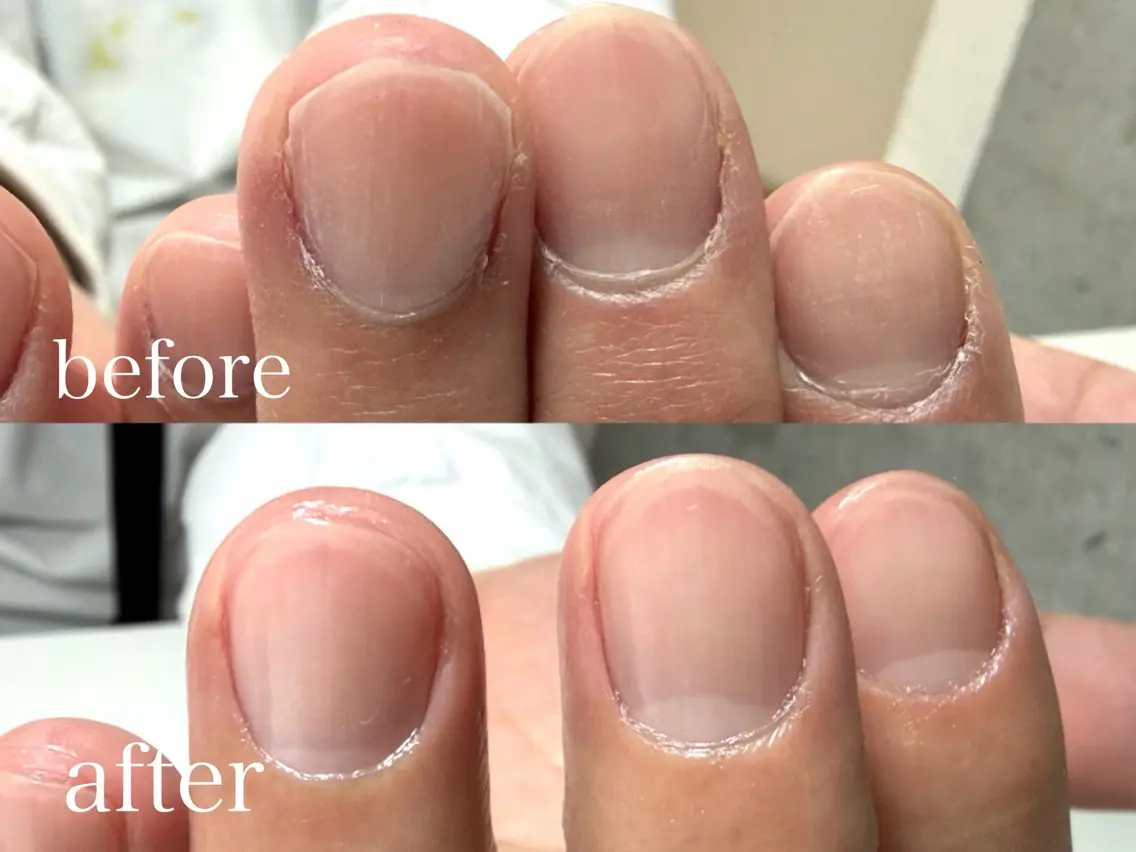 メンズ ネイル WHITE NAIL kayokoのネイルデザイン