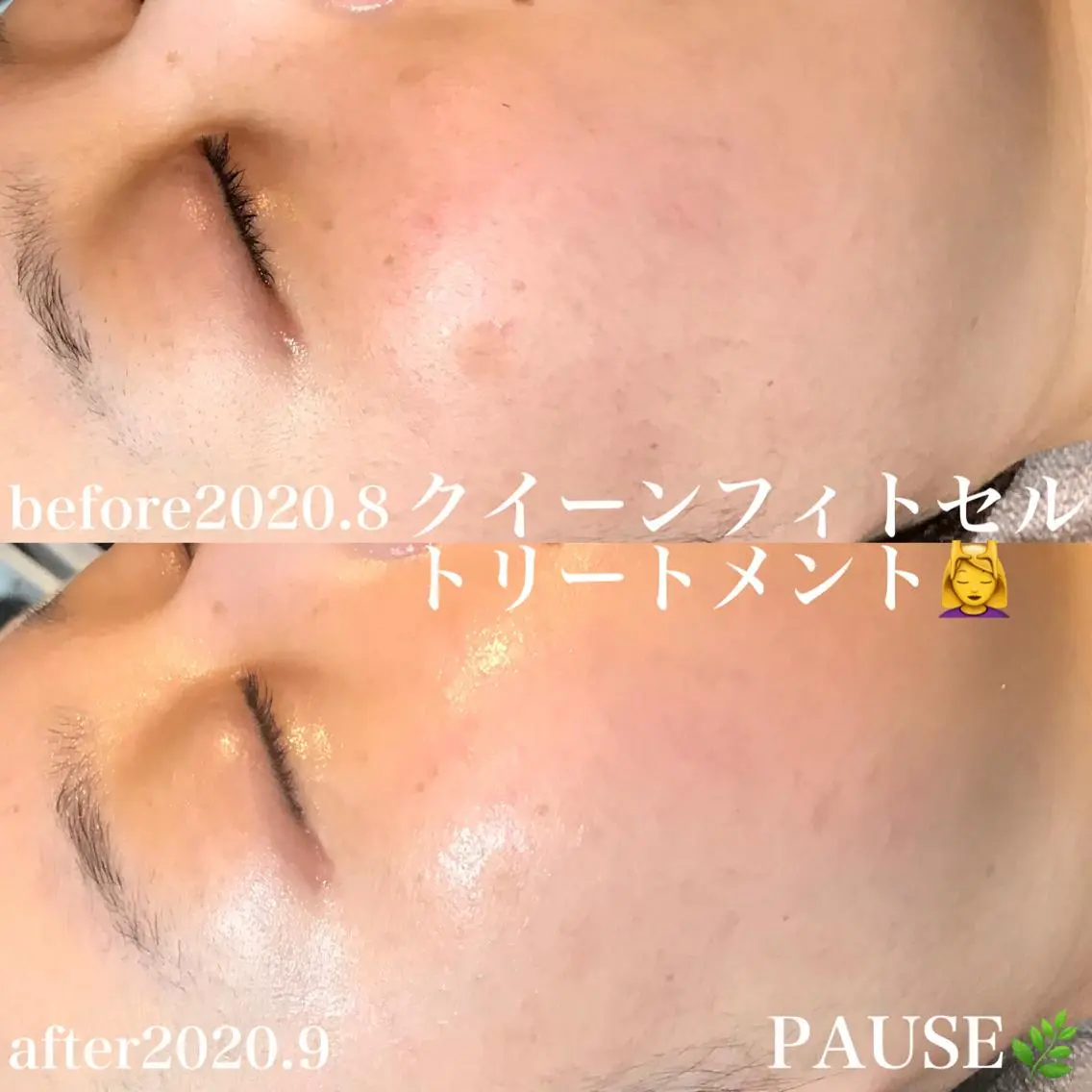 エステ 浜野 恵美のエステ・リラクイメージ
