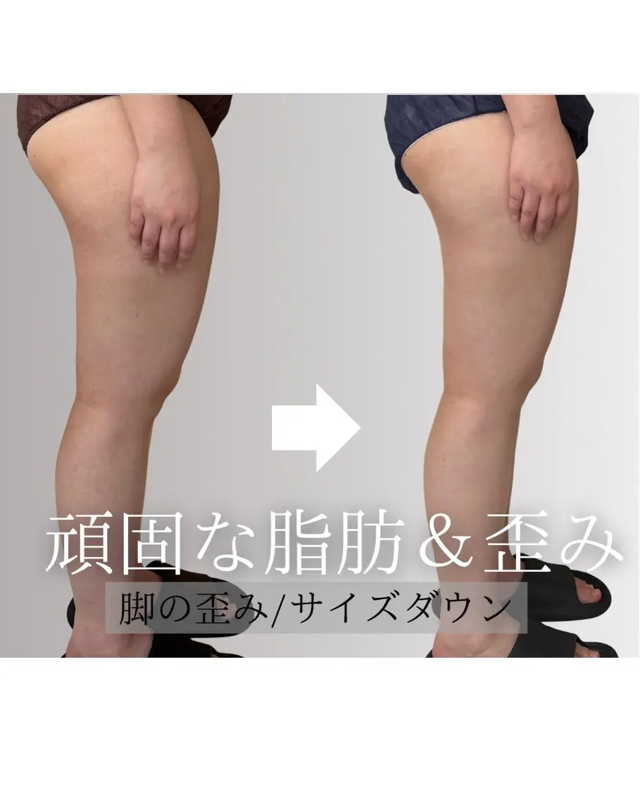 エステ リラク 姿勢改善ダイエット 🤍美容整体のエステ・リラクイメージ