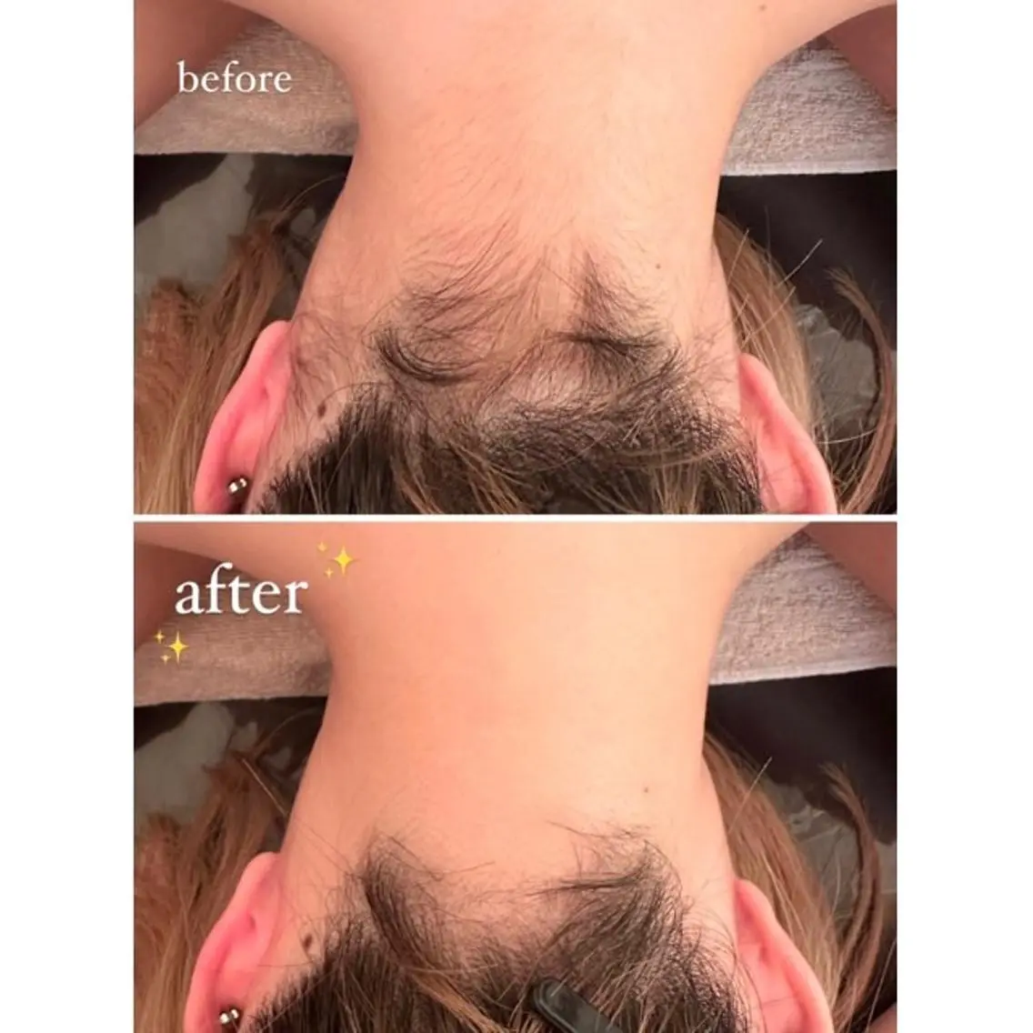 脱毛 鈴木 愛花のエステ・リラクイメージ